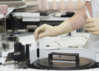 Znanstvenici razvili prvi test za otkrivanje stupnja depresije i bipolarnog poremećaja!