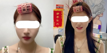 ‘Klempave’ uši novi su bizarni trend u Kini – sve više ljudi se operira kako bi ih imalo!