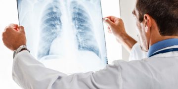 Ova biljka najbolji je lijek za plućne bolesti i tegobe, a evo i kako napraviti njen lijekoviti sirup