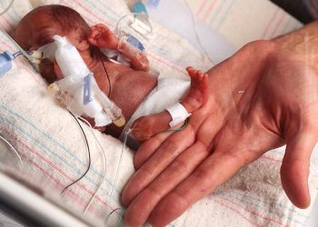 Najmanja beba na svijetu nakon 13 mjeseci napustila bolnicu