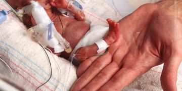 Najmanja beba na svijetu nakon 13 mjeseci napustila bolnicu