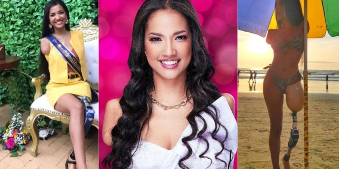 Kandidatkinja za Miss Ekvadora usprkos invaliditetu ruši sve predrasude!