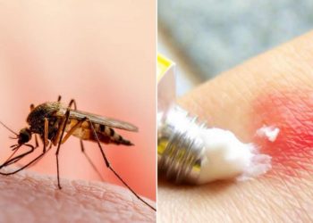 Imunolog je otkrio učinkovito sredstvo u borbi protiv svrbeža nakon uboda komaraca