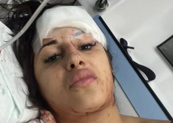 FOTO: Sandra Čaprić leži u lokvi krvi