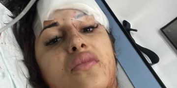 FOTO: Sandra Čaprić leži u lokvi krvi