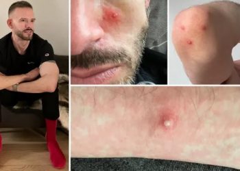 Kohn: Sexao sam se tjedno sa više muškaraca i zadesila me ova noćna mora