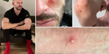 Kohn: Sexao sam se tjedno sa više muškaraca i zadesila me ova noćna mora