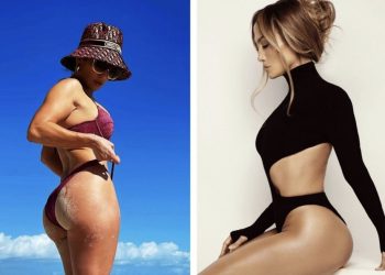 Lopez je svoju stražnjicu osigurala na 27 milijuna dolara. Da li zaista vrijedi toliko?