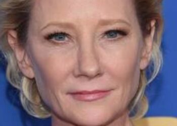 Glumica Anne Heche je u komi i bori se za život