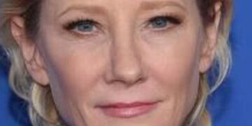 Glumica Anne Heche je u komi i bori se za život