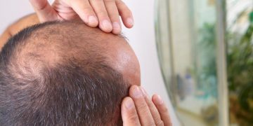 Otkriven protein za rast kose iznova.