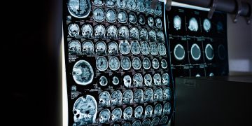 Inženjeri razvijaju naljepnice koje mogu vidjeti unutrašnjost tijela