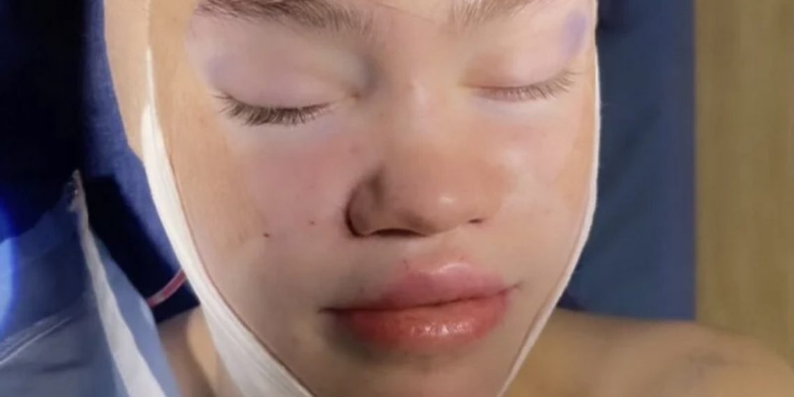 Muskova bivša djevojka objavila fotografiju u zavojima, ranije otkrila da želi “ličiti na vilenjaka”