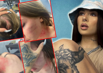 Stravično nasilje u obitelji poznate tiktokerke: Prebili joj sestru skoro na smrt, udarali i bebu