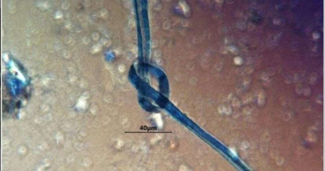 Plava vlakna pronađena u zubima drevnih Maja sugeriraju da su žrtvama bila začepljena usta prije nego što su ubijene