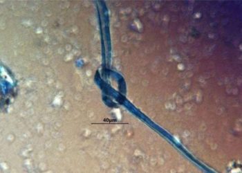 Plava vlakna pronađena u zubima drevnih Maja sugeriraju da su žrtvama bila začepljena usta prije nego što su ubijene