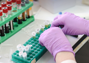 PAŽNJA! U laboratorijima već produžuju život evo i kako