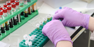 PAŽNJA! U laboratorijima već produžuju život evo i kako