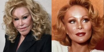 Vjerujete li vi da ova žena nije išla pod nož? Žena mačka kaže da je alergična na to!