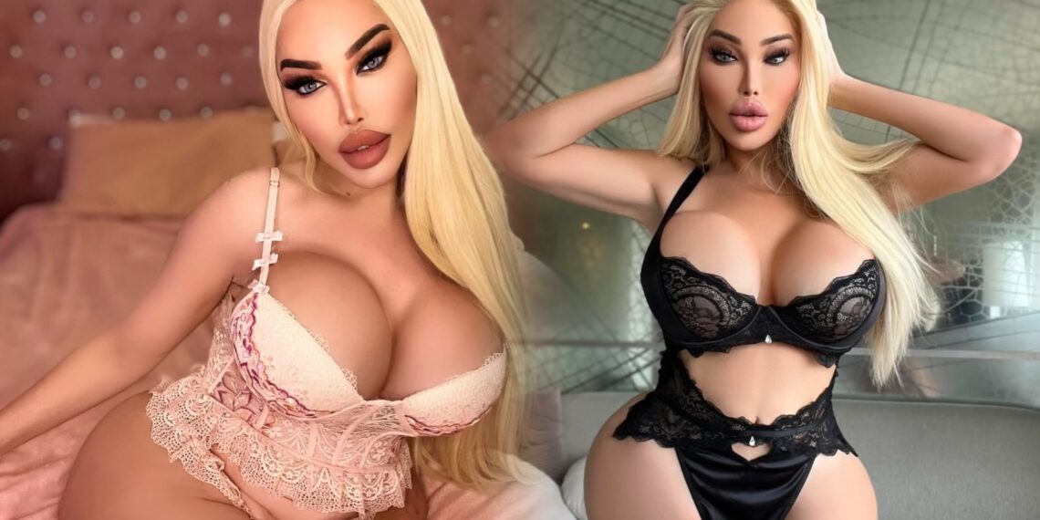 Djevojka od milijun eura: Ja sam 100 posto remek-djelo plastične kirurgije!