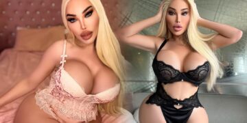 Djevojka od milijun eura: Ja sam 100 posto remek-djelo plastične kirurgije!