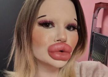 Mediji su ju prozvali bugarskom Barbie: Andrea ima najveće usne na svijetu, a želi rekordno veliku stražnjicu!
