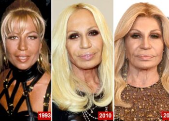 Fenomen Donatella Versace: Estetske korekcije ili samo uljepšavanje, pitanje je sad!?