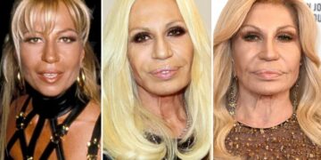 Fenomen Donatella Versace: Estetske korekcije ili samo uljepšavanje, pitanje je sad!?