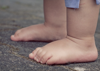 Kako prepoznati anemiju kod djece: Ovo su simptomi koje roditelji ne smiju ignorisati