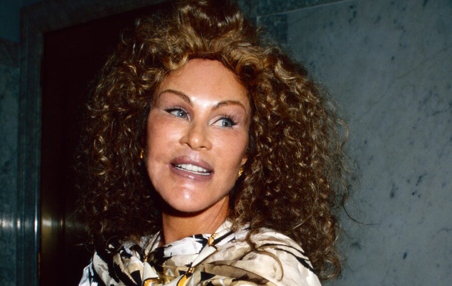 Evo od čega je stvarno umrla “žena mačka” o kojoj smo nedavno pisali: Embolija pluća ili komplikacije nakon zahvata!?