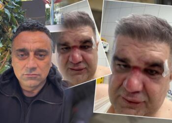 BRUTALNO PREMLAĆEN MANAGER MIROSLAVA ILIĆA I ACE LUKASA