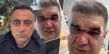 BRUTALNO PREMLAĆEN MANAGER MIROSLAVA ILIĆA I ACE LUKASA