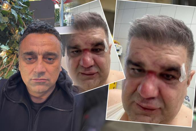 BRUTALNO PREMLAĆEN MANAGER MIROSLAVA ILIĆA I ACE LUKASA