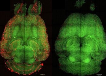 Nanočesticama na Alzheimerovu bolest