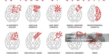 Ovo je najbrži način da obolite od demencije