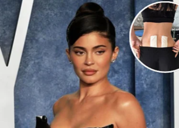 Kylie Jenner otkrila da se podvrgla terapiji matičnim ćelijama kako bi ublažila bolove u leđima nakon poroda