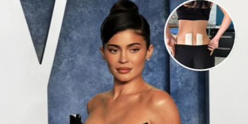 Kylie Jenner otkrila da se podvrgla terapiji matičnim ćelijama kako bi ublažila bolove u leđima nakon poroda