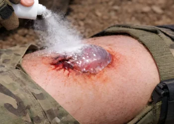 Korejski sprej trenutno zaustavlja krvarenje