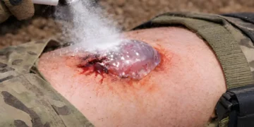 Korejski sprej trenutno zaustavlja krvarenje