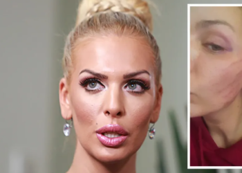 Ava Karabatić završila u bolnici nakon napada bivšeg partnera: “Bojim se za svoj život”