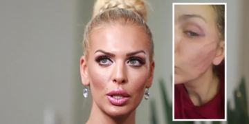 Ava Karabatić završila u bolnici nakon napada bivšeg partnera: “Bojim se za svoj život”