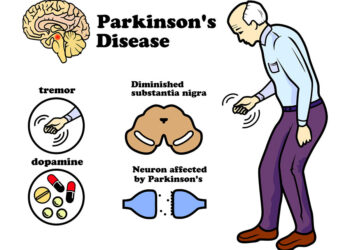 Spoj X uzrokuje Parkinsa i Alzhaimera a znanost ga uklonila