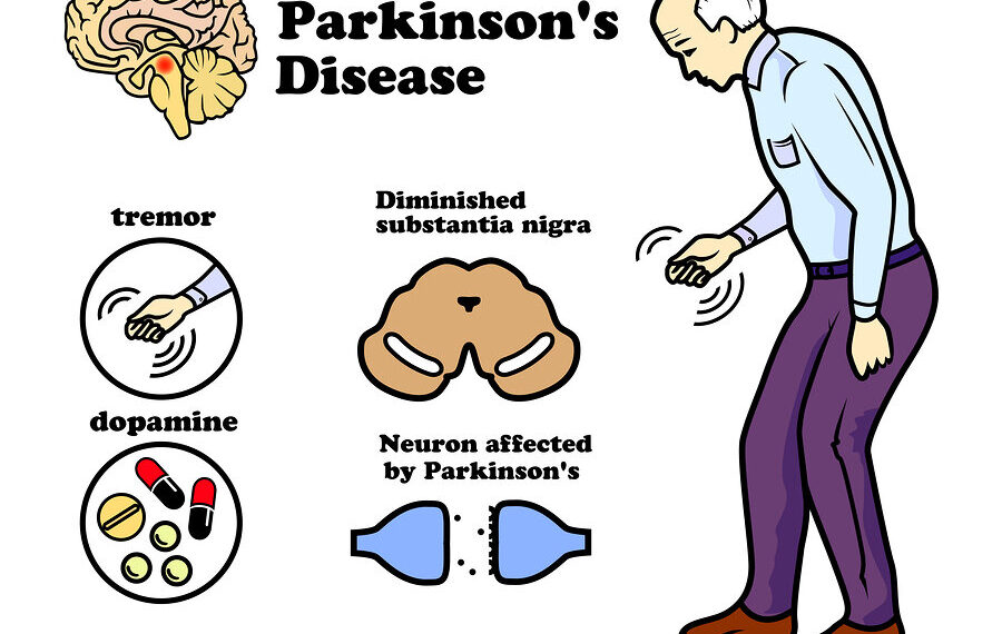Spoj X uzrokuje Parkinsa i Alzhaimera a znanost ga uklonila