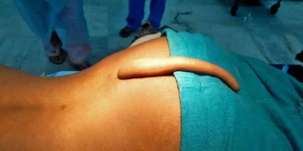 18 centimetara repa: Priča o dječaku kojeg su roditelji prihvatili onakvog kakav jest